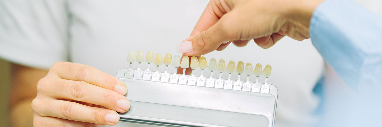 Zahnarzt Konstanz - Laubach & Partner - Praxis - Bleaching